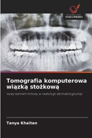 Tomografia komputerowa wiazka stozkowa (Polish Edition) 6630196996 Book Cover