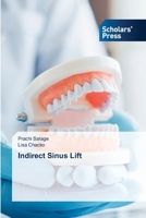 Indirect Sinus Lift 6206775305 Book Cover