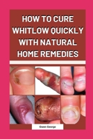 HOW TO CURE WHITLOW QUICKLY WITH NATURAL HOME REMEDIES B0CCCSTPH1 Book Cover