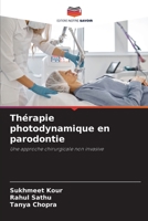 Thérapie photodynamique en parodontie: Une approche chirurgicale non invasive 6206050238 Book Cover