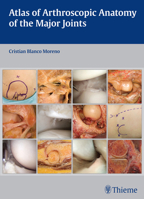 Atlas of Arthroscopic Anatomy of Major Joints T 3132037915 Book Cover