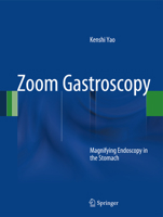 Zoom Gastroscopy: Magnifying Endoscopy in the Stomach 443154206X Book Cover