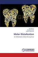 Molar Distalization: An Orthodontic distal driving force 3659540137 Book Cover