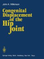 Congenital Displacement of the Hip Joint 1447113713 Book Cover