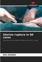 Uterine rupture in 60 cases 6207301056 Book Cover