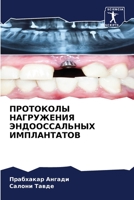 ПРОТОКОЛЫ НАГРУЖЕНИЯ ЭНДООССАЛЬНЫХ ИМПЛАНТАТОВ 6205934825 Book Cover