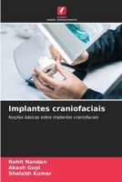 Implantes craniofaciais (Portuguese Edition) 6209895689 Book Cover