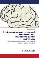 Neyrofiziologicheskiy monitoring ishemicheskogo insul'ta: elektroentsefalografiya, kognitivnye vyzvannye potentsialy 3659534188 Book Cover