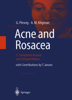 Acne and Rosacea 3642640966 Book Cover
