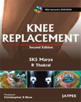 Knee Replacement 935025168X Book Cover