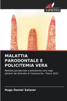 Malattia Parodontale E Policitemia Vera 6205556766 Book Cover