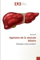 Agénésie de la vésicule biliaire 6139523001 Book Cover