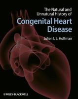 The Natural and Unnatural History of Congenital Heart Disease 1405179279 Book Cover