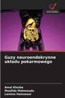 Guzy neuroendokrynne ukladu pokarmowego (Polish Edition) 6206158888 Book Cover