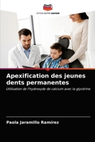 Apexification des jeunes dents permanentes: Utilisation de l'hydroxyde de calcium avec la glycérine 6203638145 Book Cover