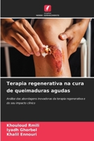 Terapia regenerativa na cura de queimaduras agudas (Portuguese Edition) 620857482X Book Cover