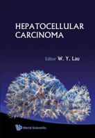 Hepatocellular Carcinoma: Basic Research 9535100238 Book Cover