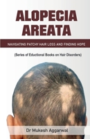 Alopecia Areata B0CPY1CYFH Book Cover