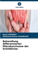 Behandlung differenzierter Mikrokarzinome der Schilddrüse (German Edition) 6630299876 Book Cover