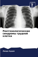 Рентгенологические синдромы грудной клетки 6205831775 Book Cover