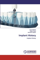 Implant History 6200486964 Book Cover