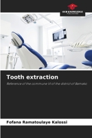 Tooth extraction 6205997630 Book Cover