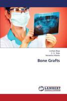 Bone Grafts 3659386669 Book Cover