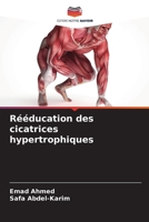 Rééducation des cicatrices hypertrophiques (French Edition) 620982319X Book Cover