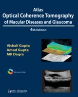 Atlas Optical Coherence Tomography of Macular Diseases and Glaucoma 9350258692 Book Cover