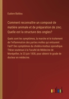 Comment reconnaître un composé de matière animale et de préparation de zinc. Quelle est la structure des ongles?: Quels sont les symptômes, la marche ... symptômes du choléra-morbus (French Edition) 3385095115 Book Cover