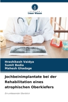 Jochbeinimplantate bei der Rehabilitation eines atrophischen Oberkiefers (German Edition) 6209869548 Book Cover