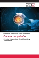 Cáncer del pulmón 6139466830 Book Cover