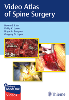 Video Atlas of Spine Surgery 1684200059 Book Cover