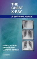 The Chest X-Ray, A Survival Guide 0702030465 Book Cover