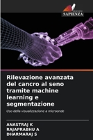 Rilevazione avanzata del cancro al seno tramite machine learning e segmentazione (Italian Edition) 6202418680 Book Cover