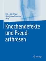 Knochendefekte Und Pseudarthrosen 3642449905 Book Cover