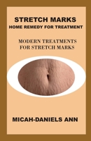 Stretch Marks Home Remedy for Treatment: Modern Treatment for Stretch Marks B0BVDYCVQW Book Cover