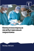 Бималлеолярные межбугорковые переломы 6206065529 Book Cover