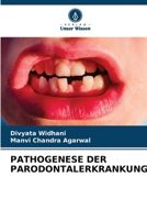Pathogenese Der Parodontalerkrankung 6205871394 Book Cover