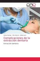 Complicaciones de la extracción dentaria: Extracción dentaria 6203038490 Book Cover