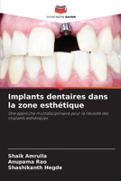 Implants dentaires dans la zone esthétique 6209068235 Book Cover