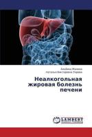 Nealkogol'naya zhirovaya bolezn' pecheni 365939307X Book Cover