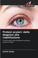 Protesi oculari: dalla diagnosi alla riabilitazione (Italian Edition) 6630243765 Book Cover