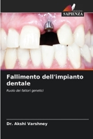 Fallimento dell'impianto dentale (Italian Edition) 6207139658 Book Cover