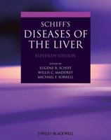 Schiff's Diseases of the Liver 0781760402 Book Cover