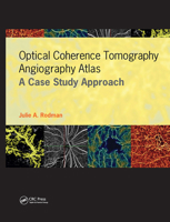 Optical Coherence Tomography Angiography Atlas: A Case Study Approach 1630916412 Book Cover