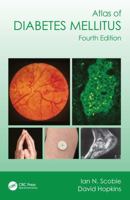 Atlas of Diabetes Mellitus 1032379456 Book Cover