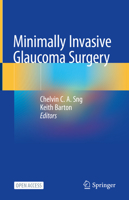 Minimally Invasive Glaucoma Surgery 9811556318 Book Cover