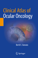 Clinical Atlas of Ocular Oncology 3030901297 Book Cover