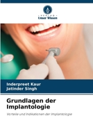 Grundlagen der Implantologie (German Edition) 6202209275 Book Cover